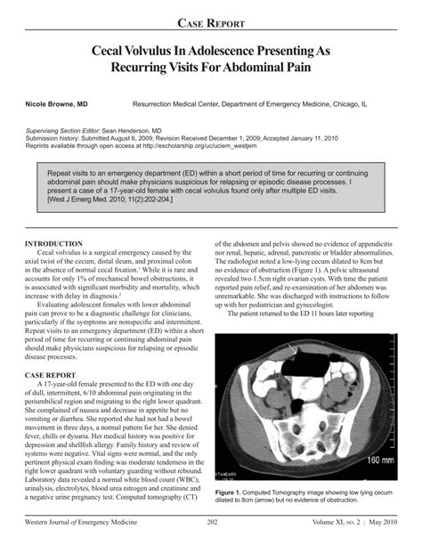 Cecal Volvulus In Adolescence Presenting As Recurring Visits For Cecal Volvulus In Adolescence Presenting As Recurring Visits For