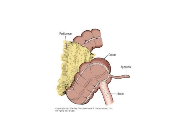 Laparoscopic Cecopexy For Mobile Cecum Syndrome As A Cause Of Chronic Laparoscopic Cecopexy For Mobile Cecum Syndrome As A Cause Of Chronic