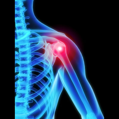 5 Orthopedic Tips